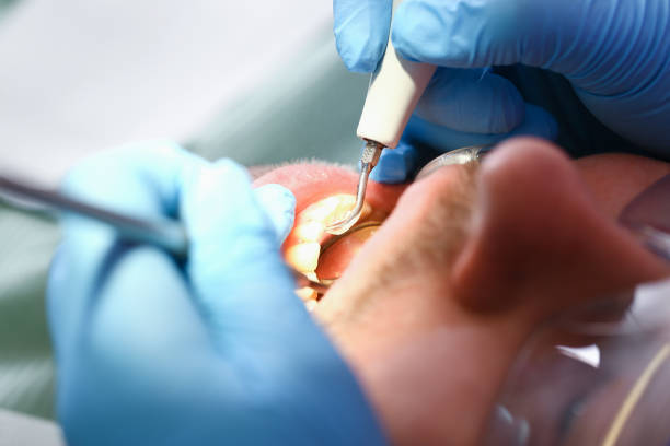 Best Broken or Chipped Tooth Repair in Warren, OH